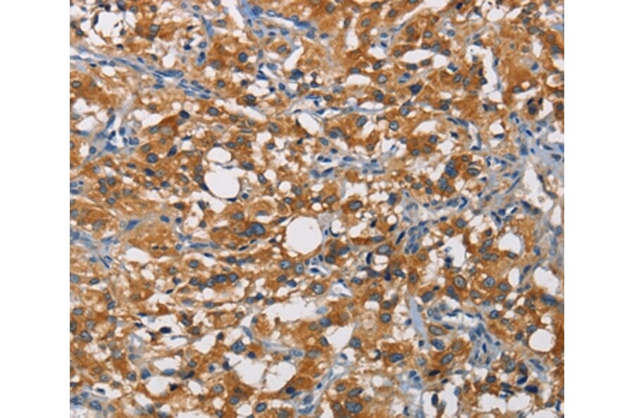 Immunohistochemistry - CRTAM Antibody from Signalway Antibody (35697) - Antibodies.com