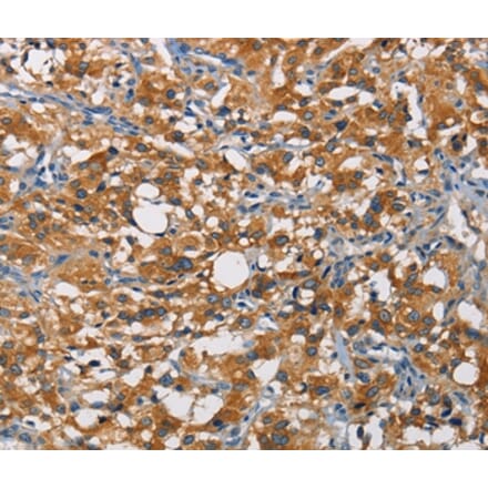 Immunohistochemistry - CRTAM Antibody from Signalway Antibody (35697) - Antibodies.com