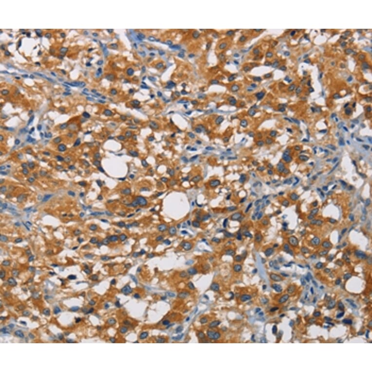 Immunohistochemistry - CRTAM Antibody from Signalway Antibody (35697) - Antibodies.com