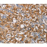 Immunohistochemistry - CRTAM Antibody from Signalway Antibody (35697) - Antibodies.com