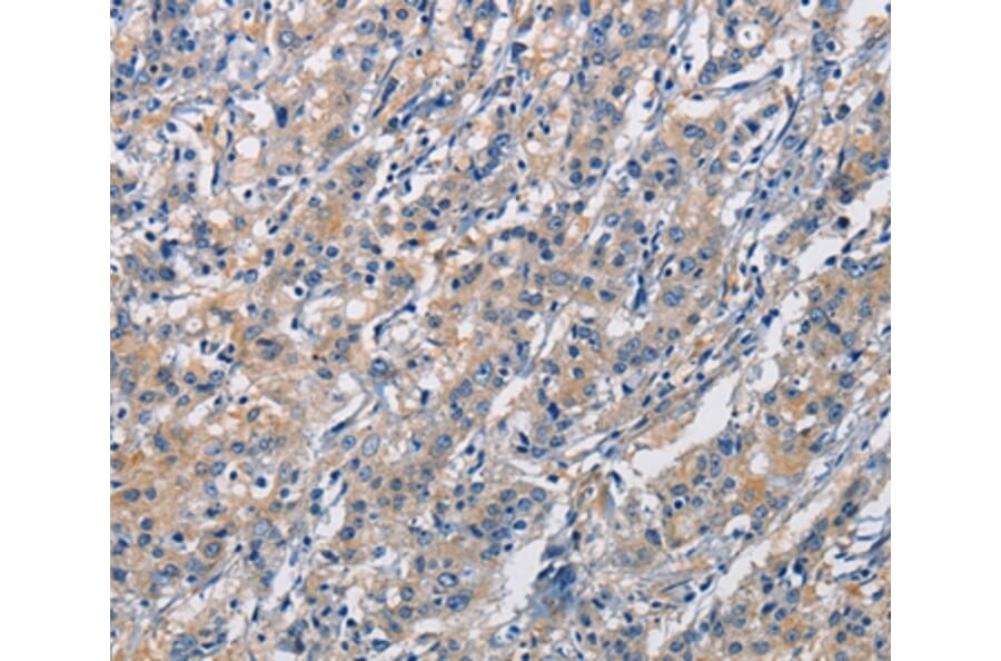 Immunohistochemistry - CRTAM Antibody from Signalway Antibody (35697) - Antibodies.com