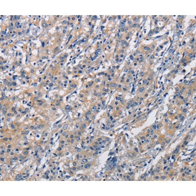 Immunohistochemistry - CRTAM Antibody from Signalway Antibody (35697) - Antibodies.com