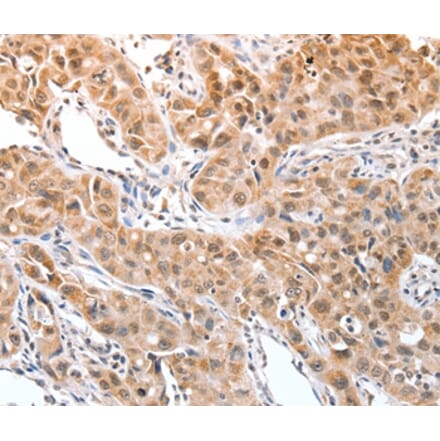 Immunohistochemistry - DPPA2 Antibody from Signalway Antibody (35716) - Antibodies.com