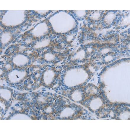 Immunohistochemistry - EGFL7 Antibody from Signalway Antibody (35721) - Antibodies.com
