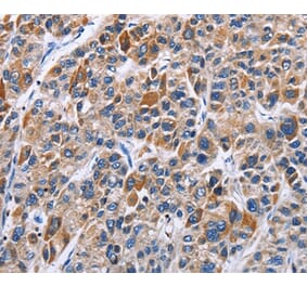 Immunohistochemistry - ENPP5 Antibody from Signalway Antibody (35725) - Antibodies.com