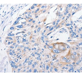Immunohistochemistry - FANCF Antibody from Signalway Antibody (35736) - Antibodies.com