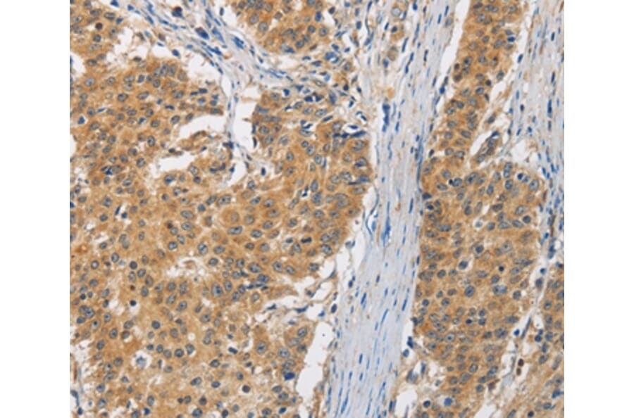 Immunohistochemistry - FASTK Antibody from Signalway Antibody (35737) - Antibodies.com