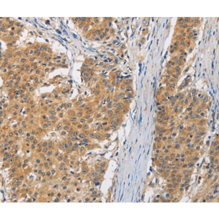 Immunohistochemistry - FASTK Antibody from Signalway Antibody (35737) - Antibodies.com