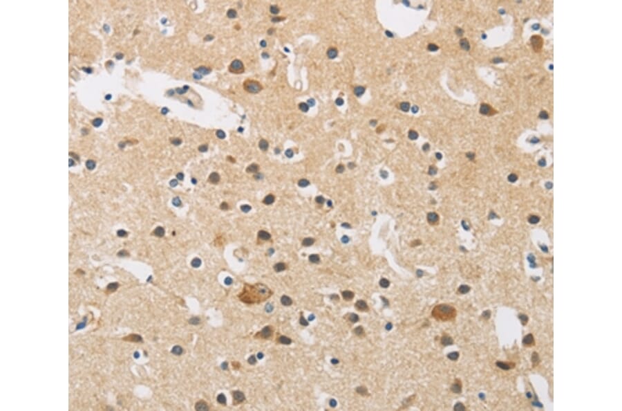 Immunohistochemistry - FASTK Antibody from Signalway Antibody (35737) - Antibodies.com