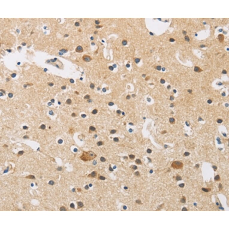 Immunohistochemistry - FASTK Antibody from Signalway Antibody (35737) - Antibodies.com