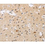 Immunohistochemistry - FASTK Antibody from Signalway Antibody (35737) - Antibodies.com