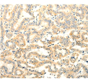 Immunohistochemistry - FOXR2 Antibody from Signalway Antibody (35740) - Antibodies.com