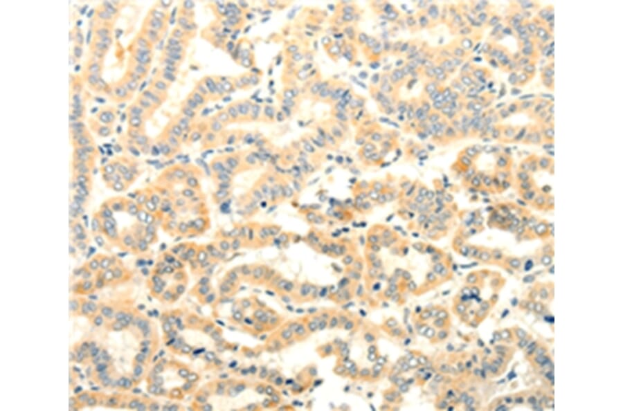 Immunohistochemistry - FOXR2 Antibody from Signalway Antibody (35740) - Antibodies.com