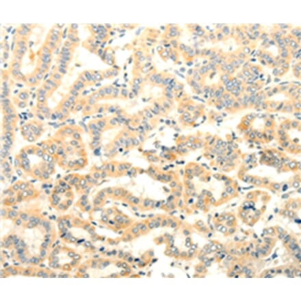 Immunohistochemistry - FOXR2 Antibody from Signalway Antibody (35740) - Antibodies.com