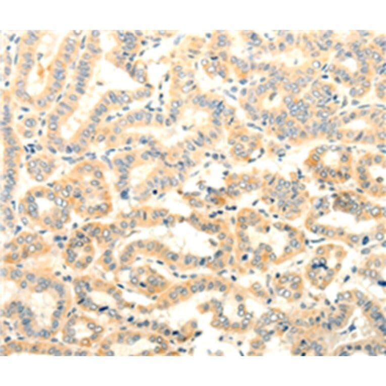 Immunohistochemistry - FOXR2 Antibody from Signalway Antibody (35740) - Antibodies.com