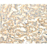 Immunohistochemistry - FOXR2 Antibody from Signalway Antibody (35740) - Antibodies.com