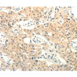 Immunohistochemistry - FOXR2 Antibody from Signalway Antibody (35740) - Antibodies.com