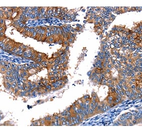 Immunohistochemistry - TBX22 Antibody from Signalway Antibody (35741) - Antibodies.com