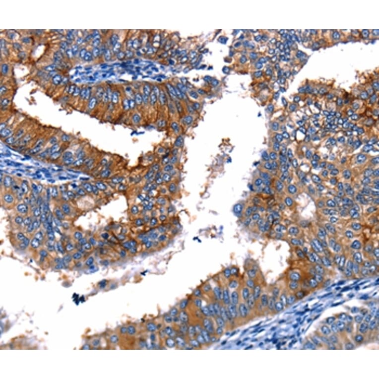 Immunohistochemistry - TBX22 Antibody from Signalway Antibody (35741) - Antibodies.com