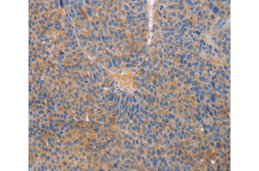 Immunohistochemistry - CXCL3 Antibody from Signalway Antibody (35751) - Antibodies.com