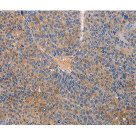 Immunohistochemistry - CXCL3 Antibody from Signalway Antibody (35751) - Antibodies.com