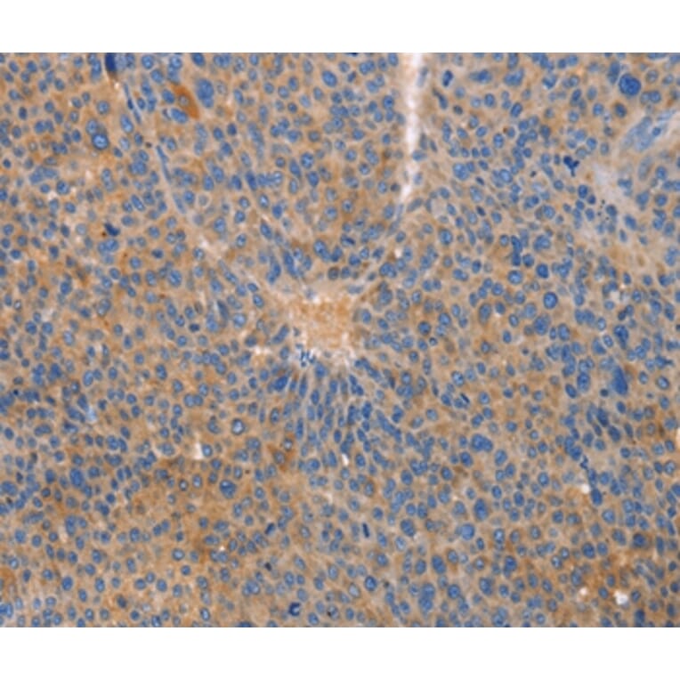 Immunohistochemistry - CXCL3 Antibody from Signalway Antibody (35751) - Antibodies.com