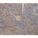 Immunohistochemistry - CXCL3 Antibody from Signalway Antibody (35751) - Antibodies.com