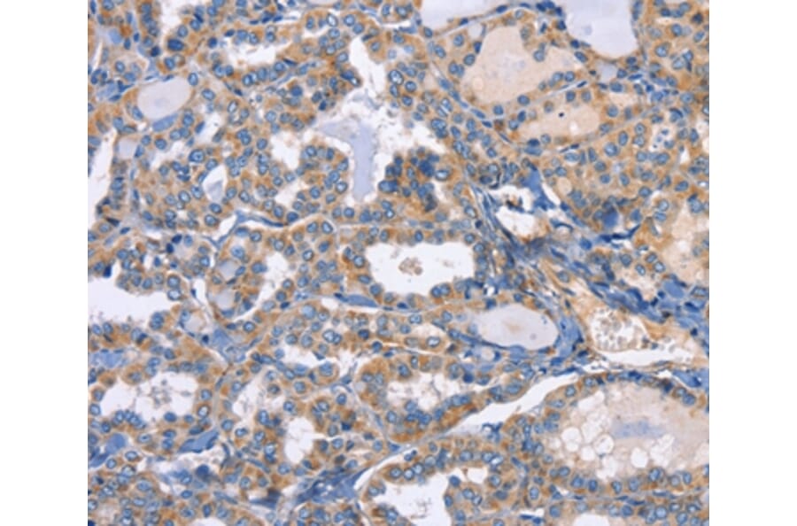 Immunohistochemistry - CXCL3 Antibody from Signalway Antibody (35751) - Antibodies.com