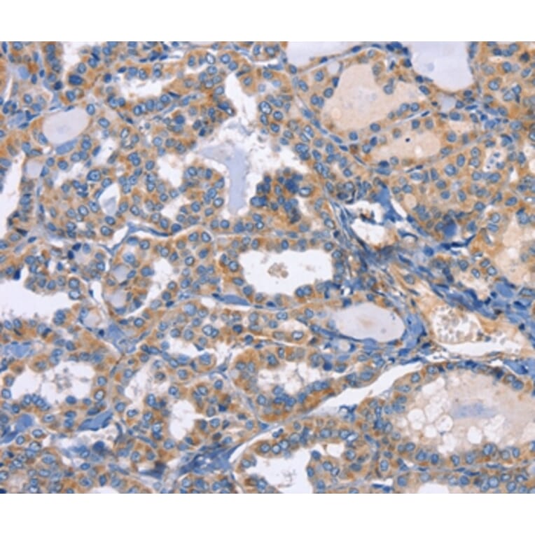 Immunohistochemistry - CXCL3 Antibody from Signalway Antibody (35751) - Antibodies.com