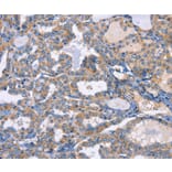 Immunohistochemistry - CXCL3 Antibody from Signalway Antibody (35751) - Antibodies.com
