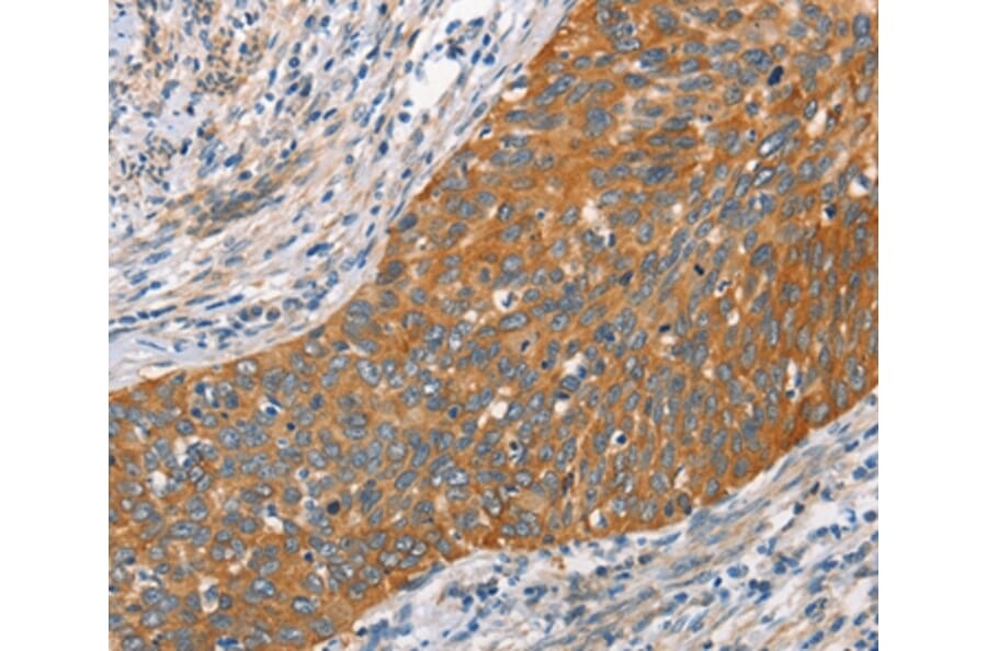 Immunohistochemistry - HSPB8 Antibody from Signalway Antibody (35772) - Antibodies.com