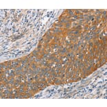Immunohistochemistry - HSPB8 Antibody from Signalway Antibody (35772) - Antibodies.com