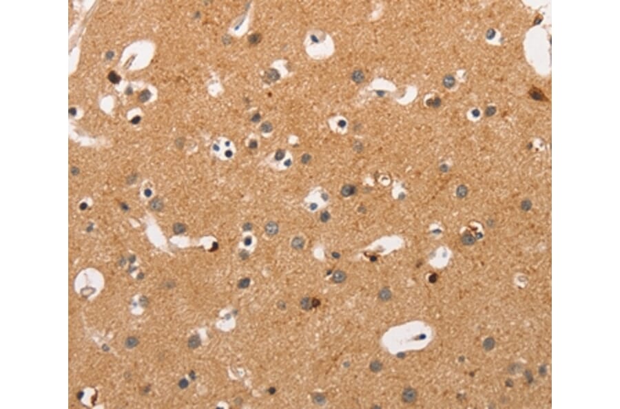 Immunohistochemistry - HSPB8 Antibody from Signalway Antibody (35772) - Antibodies.com