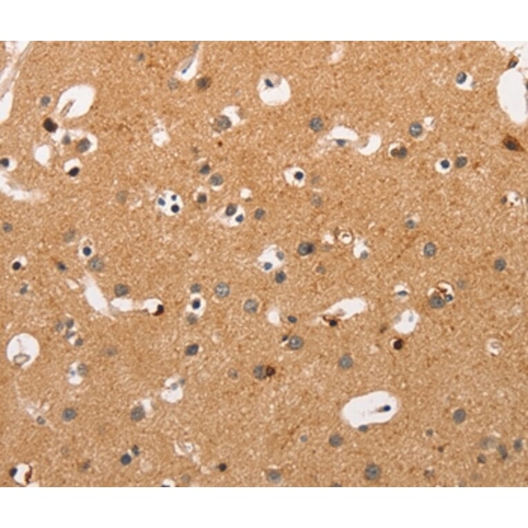Immunohistochemistry - HSPB8 Antibody from Signalway Antibody (35772) - Antibodies.com