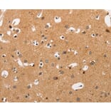 Immunohistochemistry - HSPB8 Antibody from Signalway Antibody (35772) - Antibodies.com