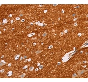 Immunohistochemistry - IGSF8 Antibody from Signalway Antibody (35775) - Antibodies.com