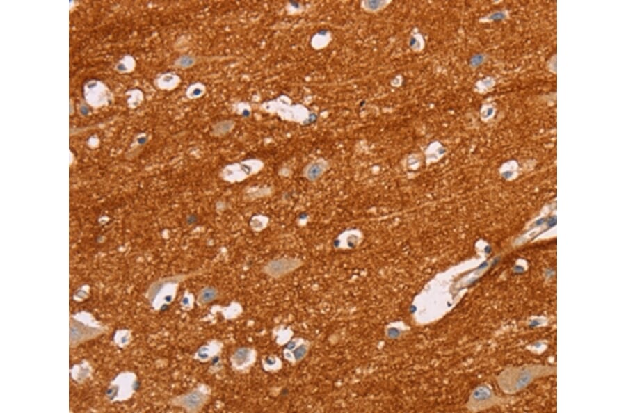 Immunohistochemistry - IGSF8 Antibody from Signalway Antibody (35775) - Antibodies.com