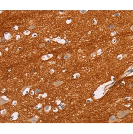 Immunohistochemistry - IGSF8 Antibody from Signalway Antibody (35775) - Antibodies.com