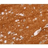 Immunohistochemistry - IGSF8 Antibody from Signalway Antibody (35775) - Antibodies.com