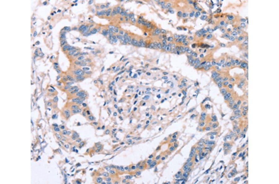 Immunohistochemistry - IGSF8 Antibody from Signalway Antibody (35775) - Antibodies.com