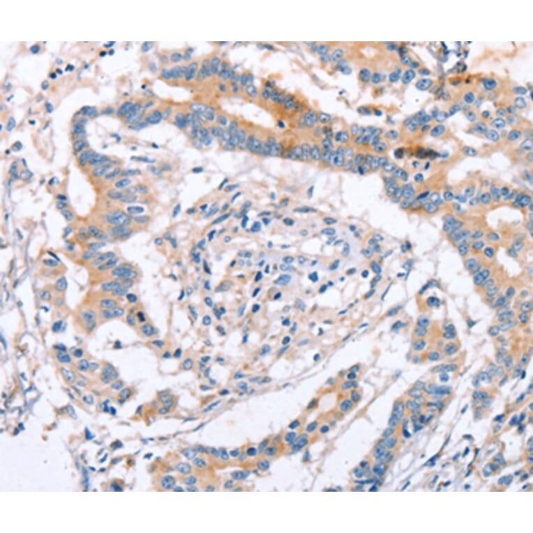 Immunohistochemistry - IGSF8 Antibody from Signalway Antibody (35775) - Antibodies.com
