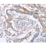 Immunohistochemistry - IGSF8 Antibody from Signalway Antibody (35775) - Antibodies.com