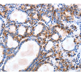 Immunohistochemistry - IGSF6 Antibody from Signalway Antibody (35776) - Antibodies.com