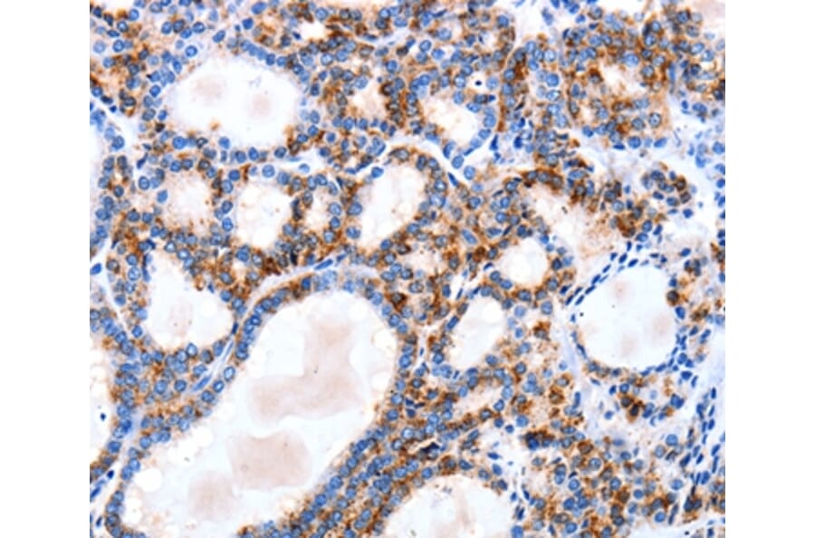 Immunohistochemistry - IGSF6 Antibody from Signalway Antibody (35776) - Antibodies.com