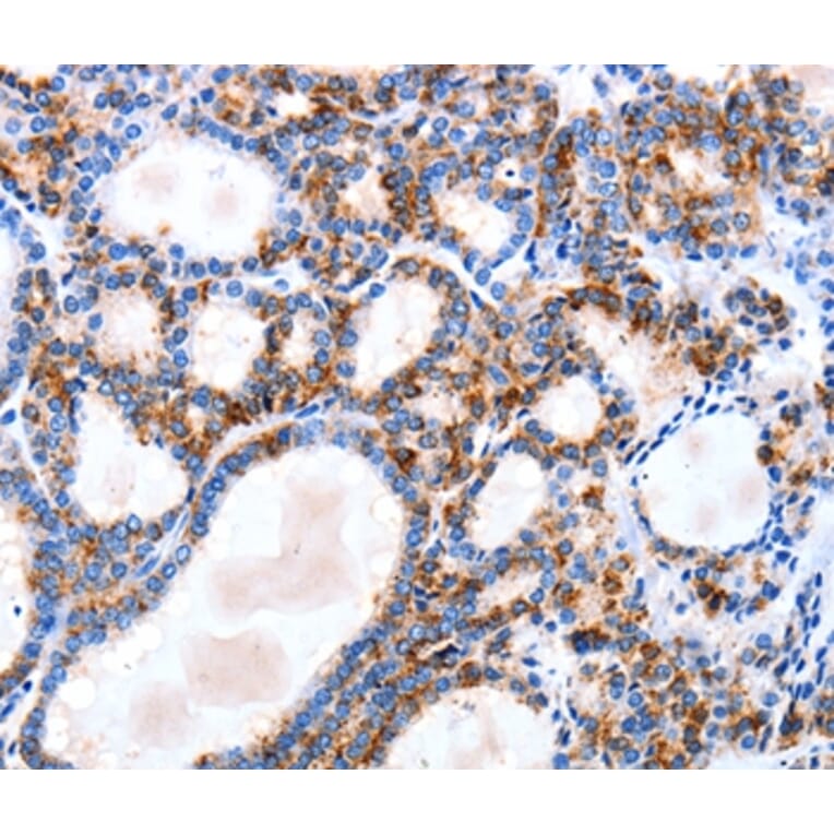 Immunohistochemistry - IGSF6 Antibody from Signalway Antibody (35776) - Antibodies.com
