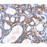 Immunohistochemistry - IGSF6 Antibody from Signalway Antibody (35776) - Antibodies.com