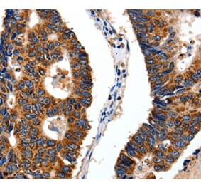 Immunohistochemistry - ITGB6 Antibody from Signalway Antibody (35783) - Antibodies.com