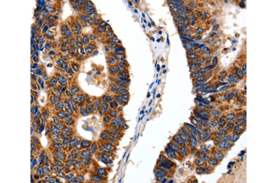 Immunohistochemistry - ITGB6 Antibody from Signalway Antibody (35783) - Antibodies.com