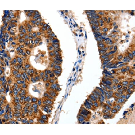 Immunohistochemistry - ITGB6 Antibody from Signalway Antibody (35783) - Antibodies.com