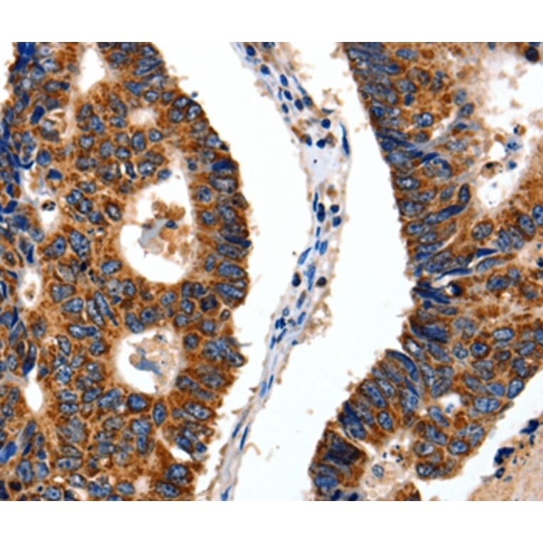 Immunohistochemistry - ITGB6 Antibody from Signalway Antibody (35783) - Antibodies.com